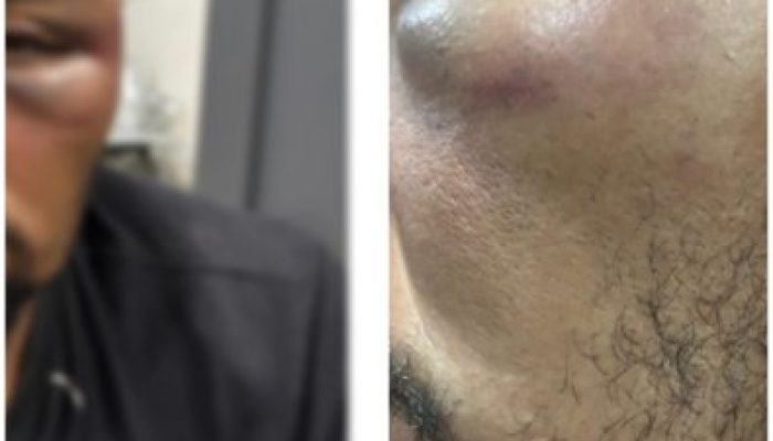 226681159bc6adda094ea209635fc2d9