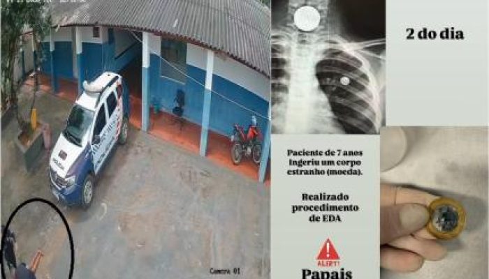 CRIANCA-ENGASGA-COM-MOEDA