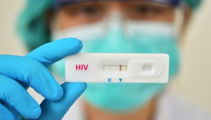 HIV